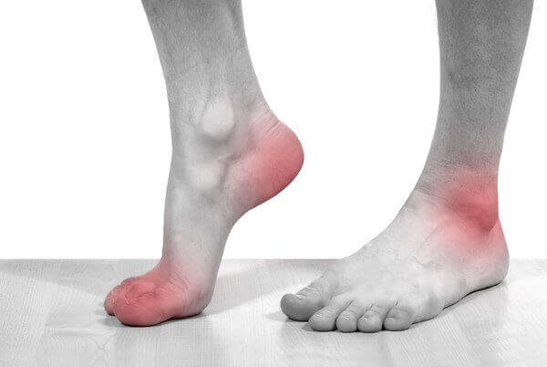 Bệnh Gout: Nguyên nhân, dấu hiệu, triệu chứng và cách chữa trị