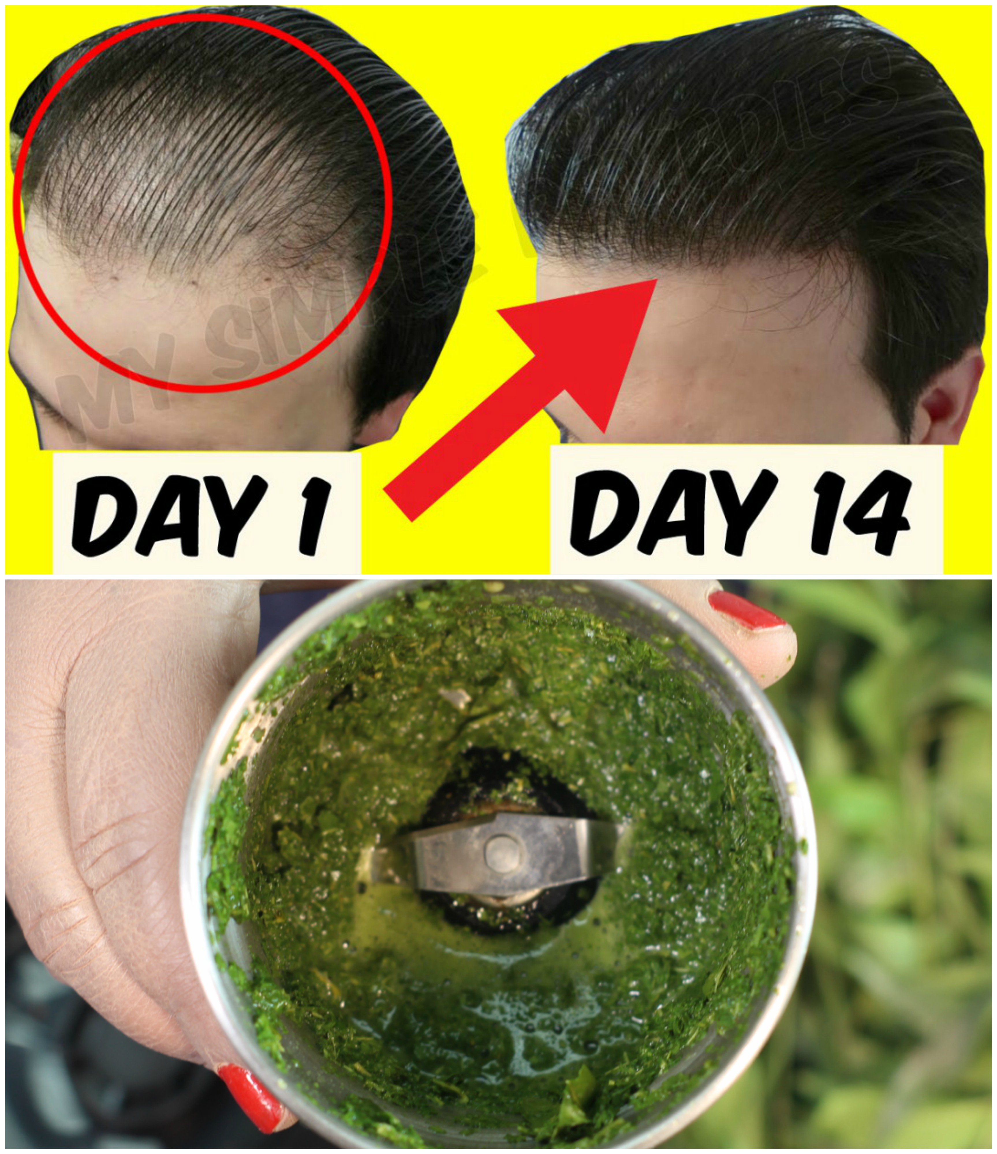 Cách sử dụng bột neem trị gàu chăm sóc tóc
